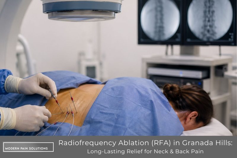 Radiofrequency Ablation (RFA) in Granada Hills Long-Lasting Relief for Neck & Back Pain
